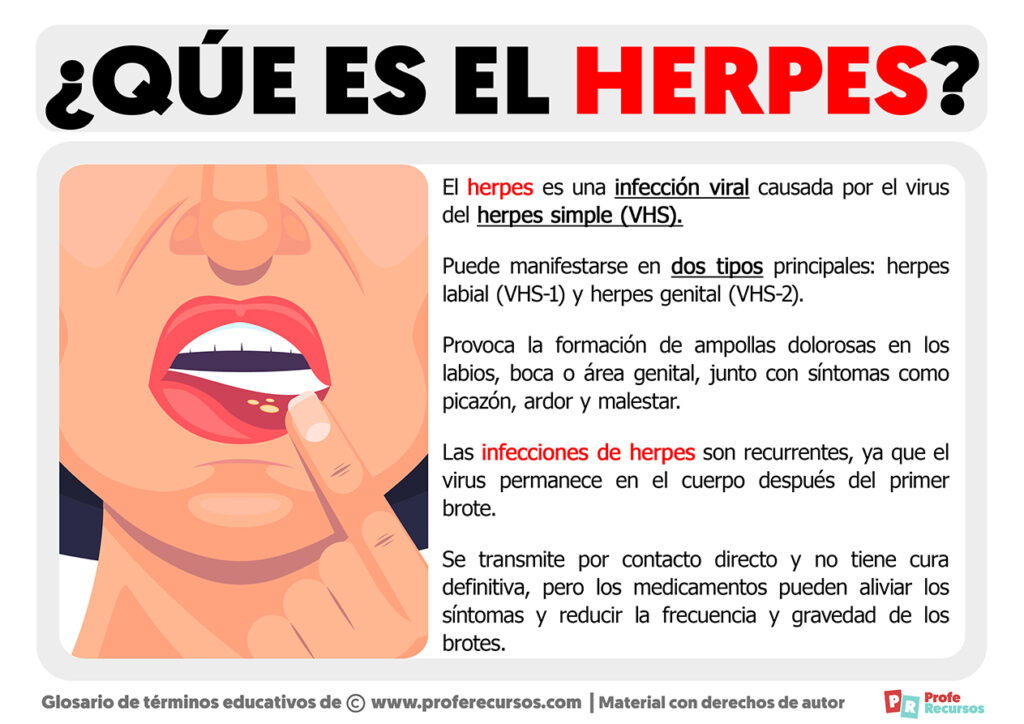 Qu Es El Herpes Definici N De Herpes