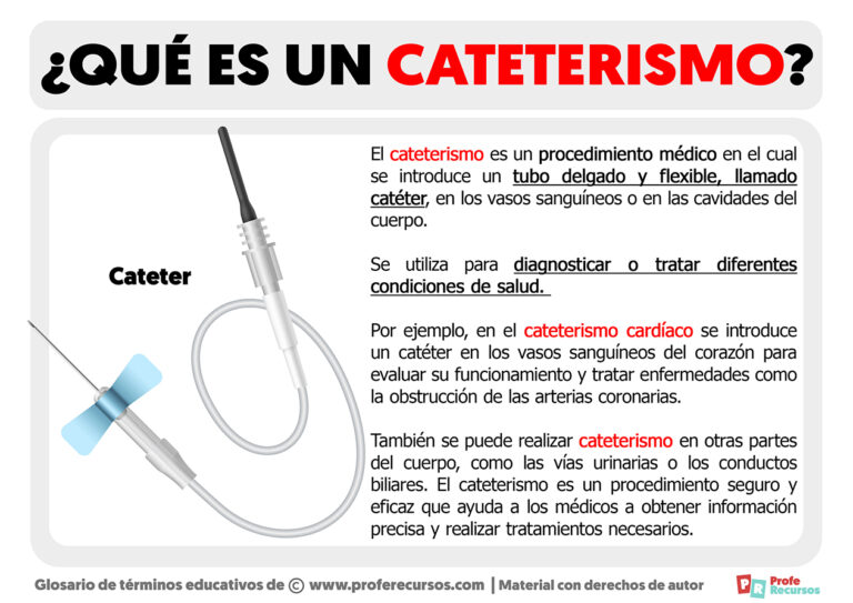 Qu Es Un Cateterismo Definici N De Cateterismo