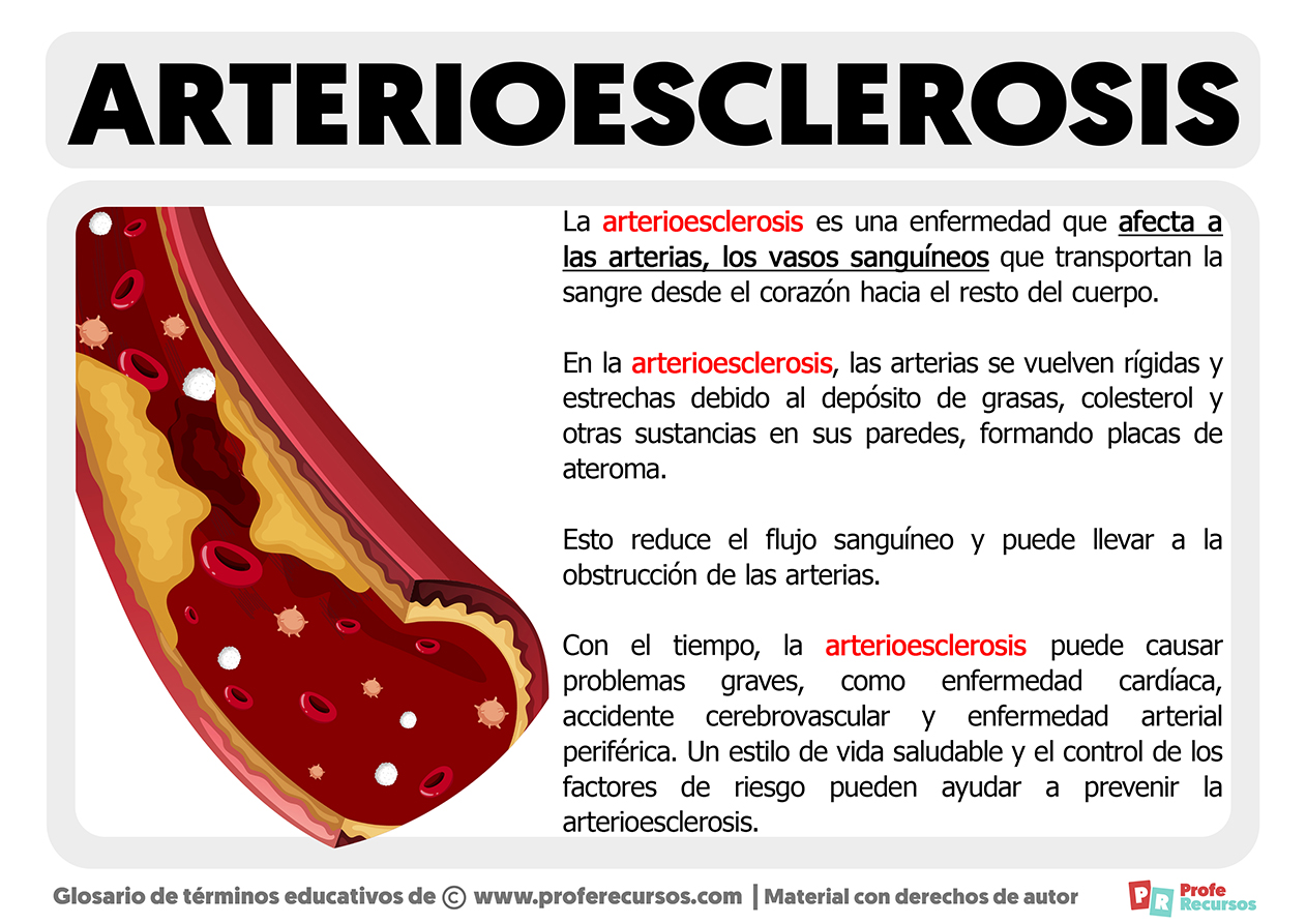 Que es la arterioesclerosis