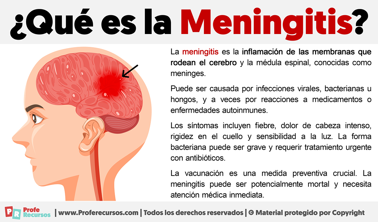 Que es la meningitis
