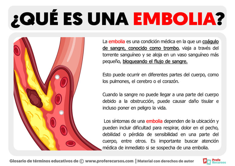 Qué Es Una Embolia Definición De Embolia