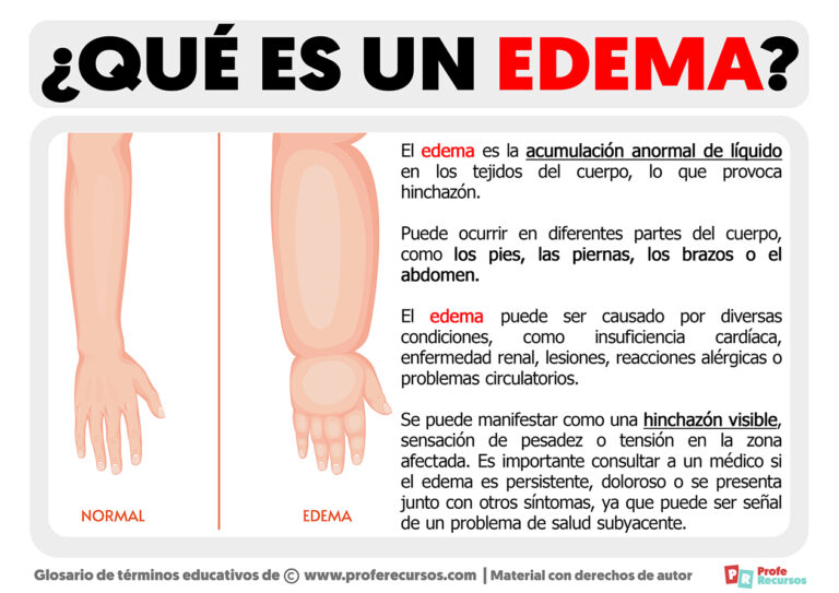 Qué Es Un Edema Definición De Edema