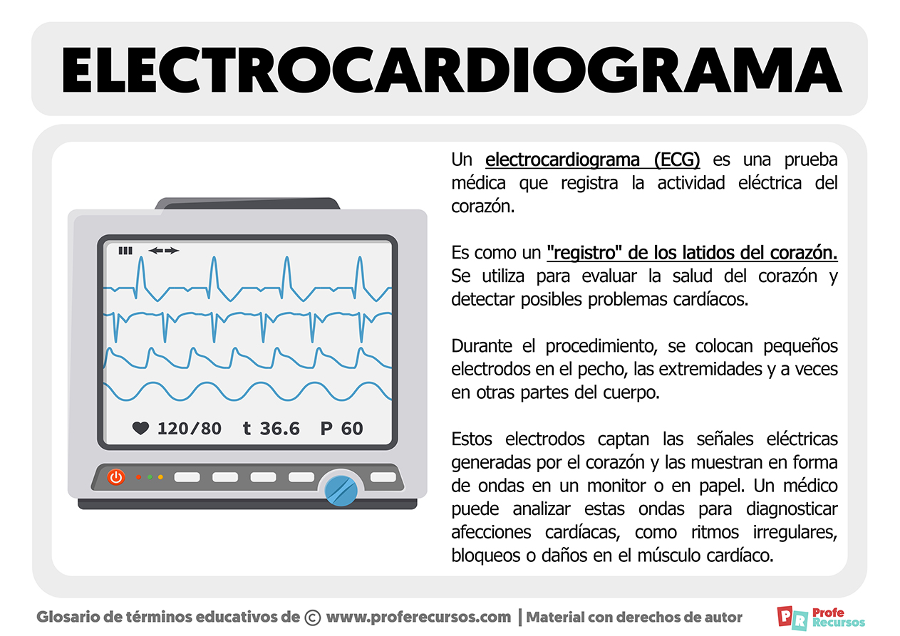 Que es un electrocardiograma
