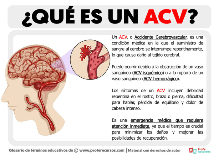 Qué Es Una Acv Definición De Acv 7412