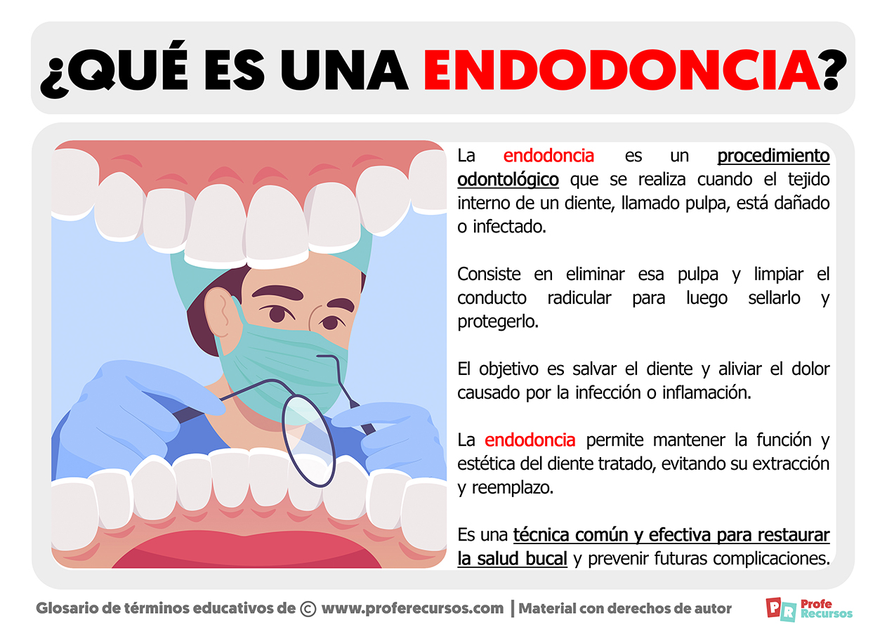 Que es una endodoncia